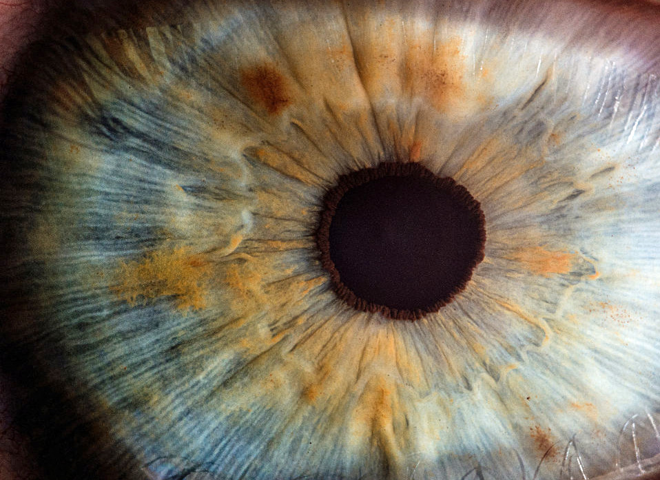 ojo